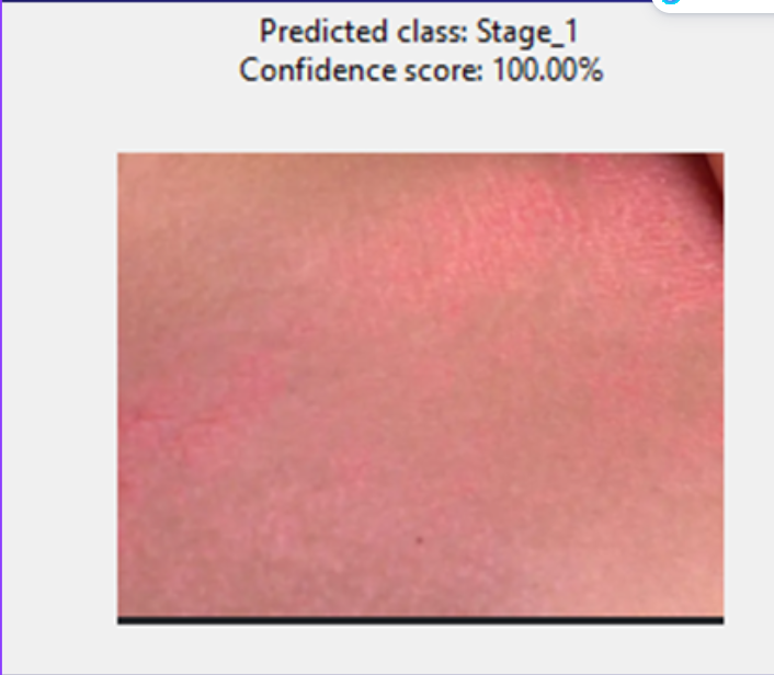 Healthy wound sample