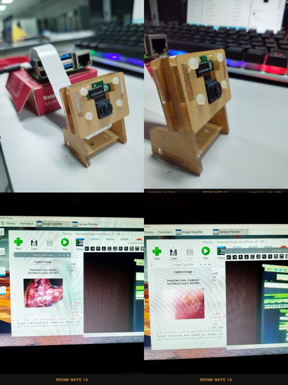 Main wound classification project demo