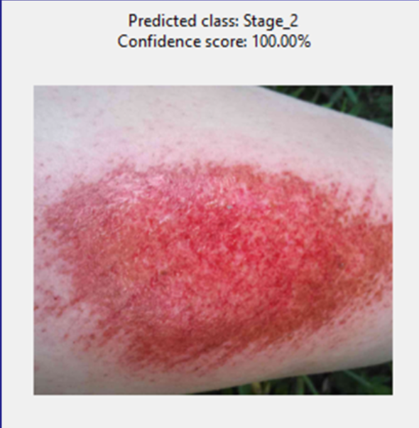 Mild wound sample